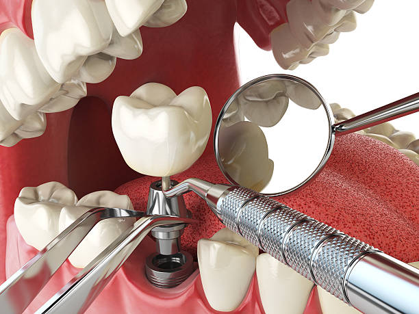 Best Emergency Gum Pain Relief  in La Pine, OR